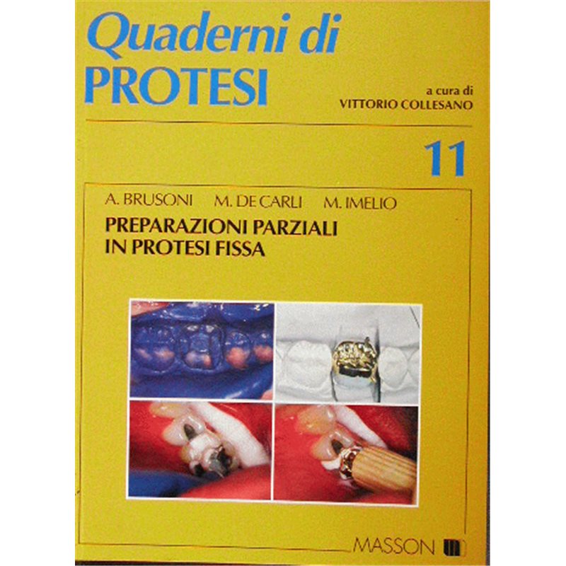Quaderni di Protesi - 11 - Preparazioni parziali in protesi fissa